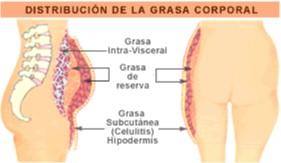 celulitis