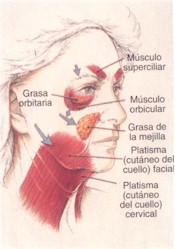 Esquema lifting de rostro