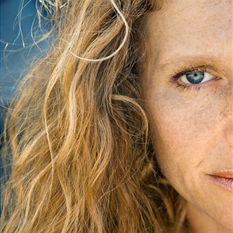 Lser y Luz Pulsada en el tratamiento de lesiones pigmentarias y vasculares